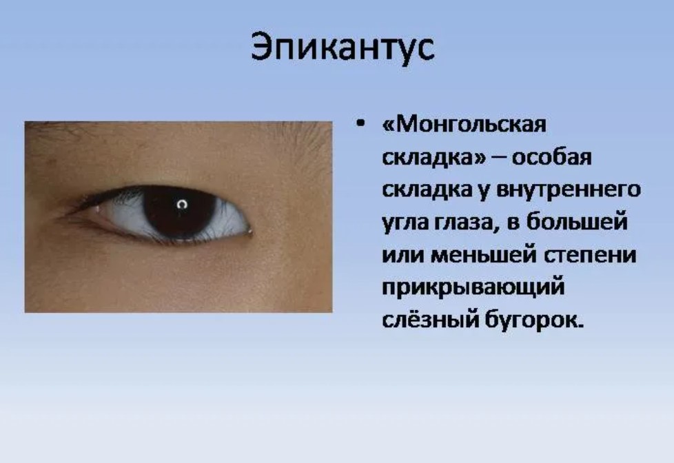 Узкий разрез глаз какая раса. Эпикантус монгольская складка. Складка верхнего века эпикантус. Разрез глаз эпикантус. Эпикант, монголоидный разрез глаз.